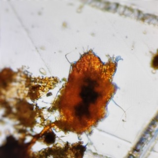 An image of a tardigrade moving under a microscope.